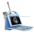 MSLPU27M 2016 New Protable Ultrasound Scanner doppler ultrasound machine price
